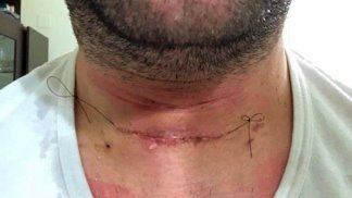 inquinamento-ambientale-la-foto-shock-del-sindaco-di-pertosa