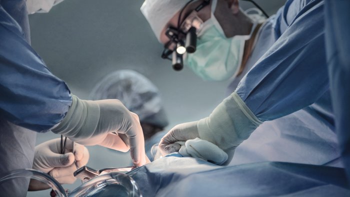 cardiochirurgia hi tech intervento innovativo alla federico ii di napoli