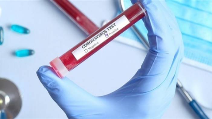 rsa tutti negativi gli 87 test covid a villa clementina