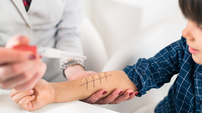 allergie nei bambini e allarme ricerca in campania 30 per cento in 10 anni