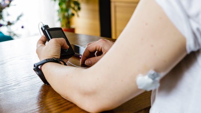 diabete quali pazienti in campania possono avere il sensore per la glicemia