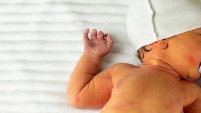 bimbo di 9 mesi in condizioni critiche indagini in corso