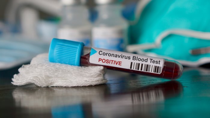 coronavirus ancora un positivo a san giorgio la molara