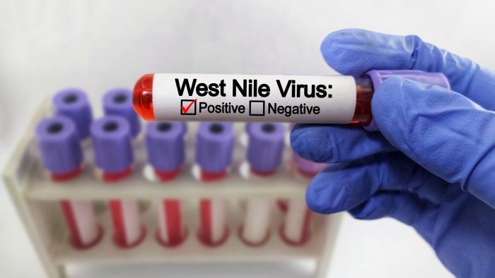 virus west nile muore un 83enne di capua e l ottava vittima nel casertano