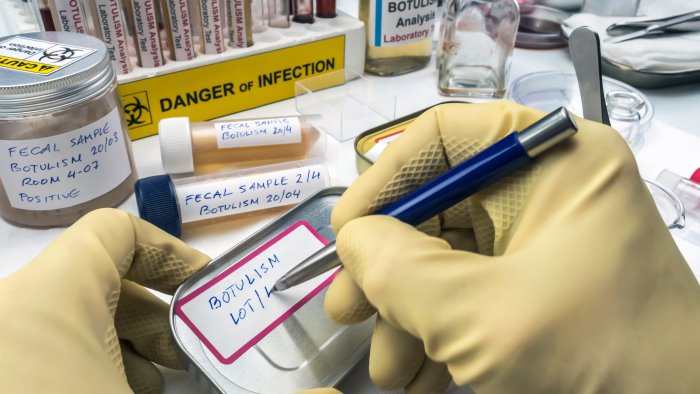 intossicato dal botulino in calabria ora fuori pericolo