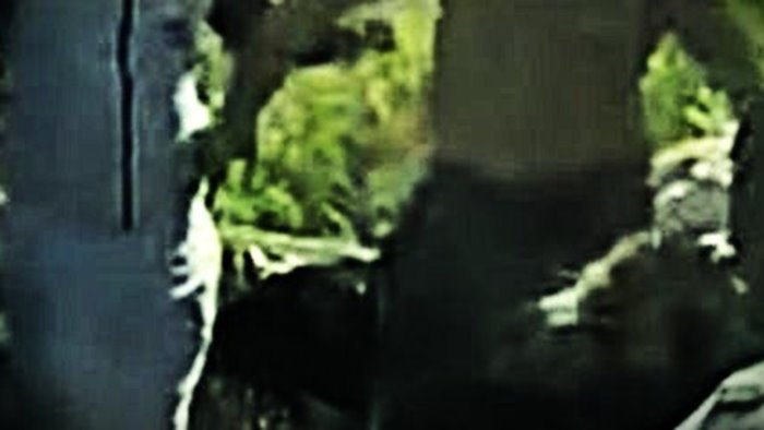 ragazzo affetto da due malattie genetiche aggredito con violenza dal branco