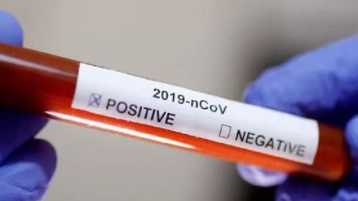 covid irpinia aumentano i contagi 15 a cervinara