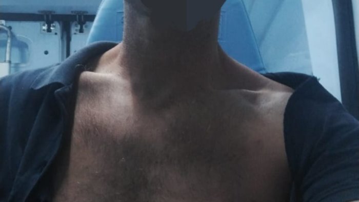 autista di busitalia aggredito con sputi e pugni in testa condotto in ospedale