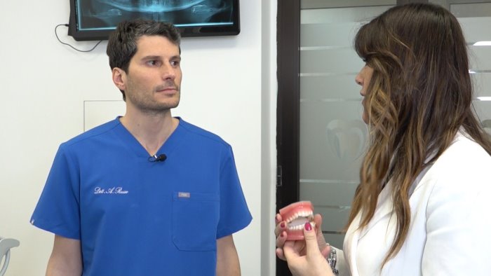 avellino la salute dei denti ecco perche scegliere gli allineatori trasparenti